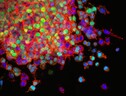 La mappa genetica dei tumori getta nuova luce su come nasconoe cambiano nel tempo le cellule malate (fonte: National Cancer Institute via unsplash) (ANSA)