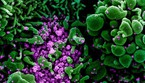 In violetto le particelle di SarsCoV2 durante un'infezione, viste al microscopio elettronico (fonte: NIAID-RML) (ANSA)