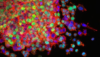 La mappa genetica dei tumori getta nuova luce su come nasconoe cambiano nel tempo le cellule malate (fonte: National Cancer Institute via unsplash) (ANSA)