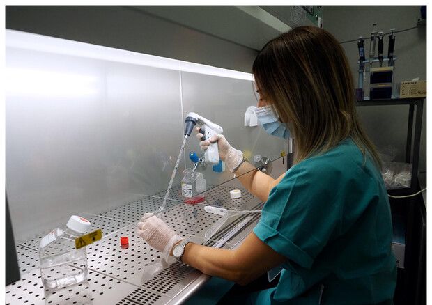 Diabete: scoperta proteina killer dei reni, verso nuove cure © ANSA