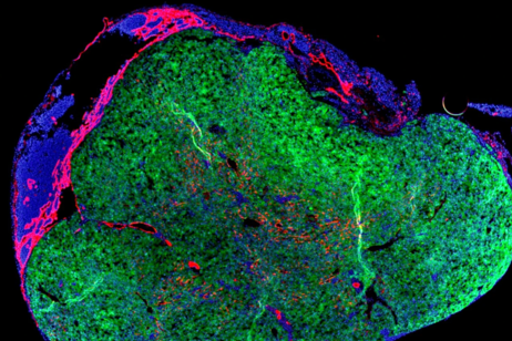 Linfonodo di topo in cui sono state iniettate cellule di fegato (in verde) (fonte: Lagasse Lab via Nature)