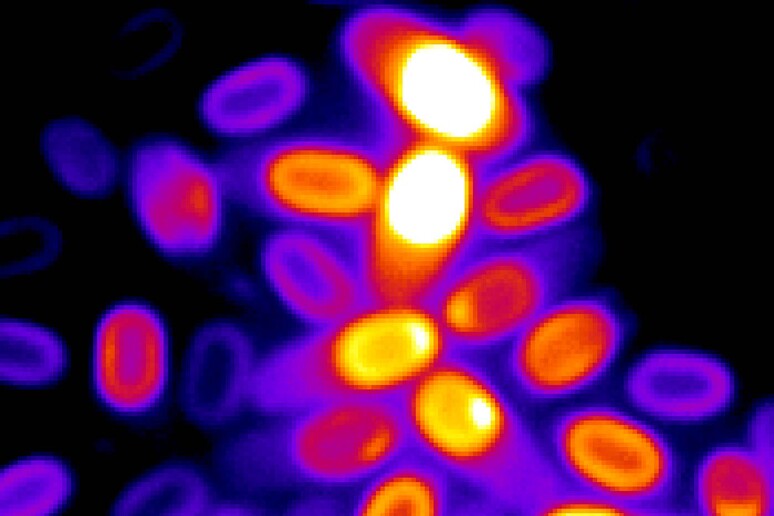 Un 'immagine al microscopio di diverse spore batteriche che mostra anche il loro stato di attivazione (Fonte: Suel Lab – Kaito Kikuchi and Leticia Galera) - RIPRODUZIONE RISERVATA