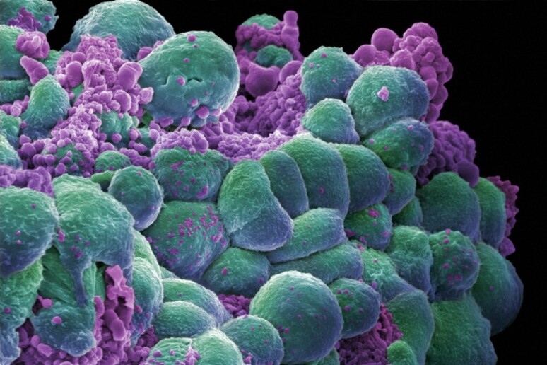 Cellule del tumore del seno (fonte: Annie Cavanagh. Wellcome Images, images@wellcome.ac.uk) - RIPRODUZIONE RISERVATA