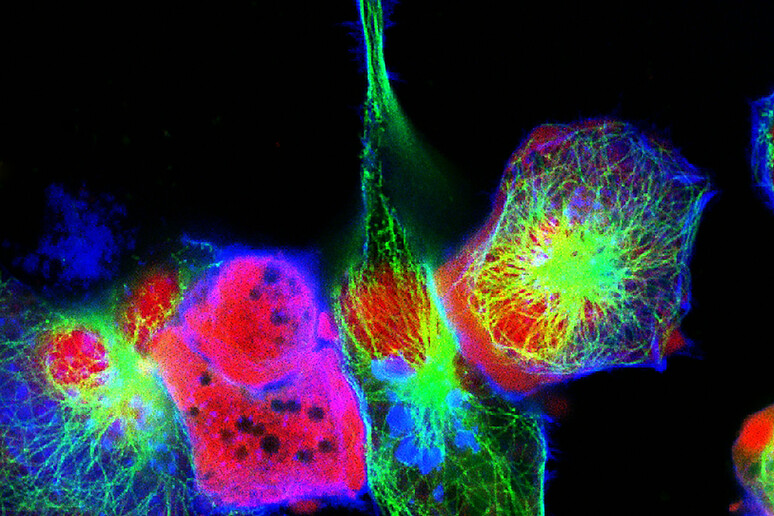 Cellule di neuroblastoma (fonte: vshivkova, da iStock) -     RIPRODUZIONE RISERVATA