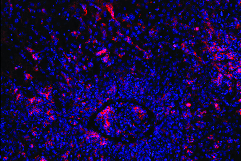 Cellule T malate scatenano un 'eccessiva risposta immunitaria, ostruendo un vaso sanguigno (al centro) (fonte: Elijah D. Lowenstein and Xun Li, K. Rajewsky Lab, Max Delbrück Center) -     RIPRODUZIONE RISERVATA