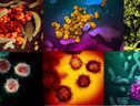 Immagini del coronavirus SarsCov2 ottenute dal Niaid con il microscopio elettronico (fonte: NIAID-RML)  (ANSA)