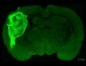 L'organoide umano impiantato nel cervello di ratto, contrassegnato con una proteina fluorescente per renderlo visibile (fonte: Stanford University) (ANSA)