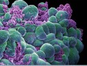 Cellule del tumore del seno (fonte: Annie Cavanagh. Wellcome Images, images@wellcome.ac.uk) (ANSA)