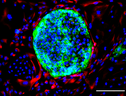 Immagine ottenuta con microscopio a fluorescenza: le nuove cellule sono contrassegnate in rosso e le cellule corrispondenti alle cellule staminali placentari sono mostrate in verde; in blu il Dna di ciascuna cellula (Fonte: Amitesh Panda (KU Leuven)) (ANSA)