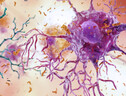 Rappresentazione artistica di neuroni colpiti dall'Alzheimer (fonte: NIA-NIH) (ANSA)