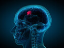 Per il tumore al cervello nuove terapie (ANSA)