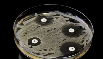 L'intelligenza artificiale accelera la ricerca sugli antibiotici contro i superbatteri (fonte: Pxfuel) (ANSA)