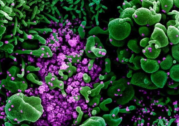 In violetto le particelle di SarsCoV2 durante un'infezione, viste al microscopio elettronico (fonte: NIAID-RML) © Ansa