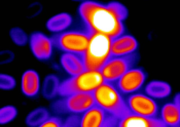 Un'immagine al microscopio di diverse spore batteriche che mostra anche il loro stato di attivazione (Fonte: Suel Lab – Kaito Kikuchi and Leticia Galera) © Ansa