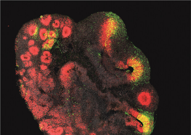 Organoide cerebrale di 3 millimetri ottenuto a partire da cellule staminali di scimpanzé: in rosso le normali cellule staminali, in verde quelle che hanno ricevuto il gene ARHGAP11B responsabile del maggiore sviluppo (Fonte: Jan Fischer) © Ansa