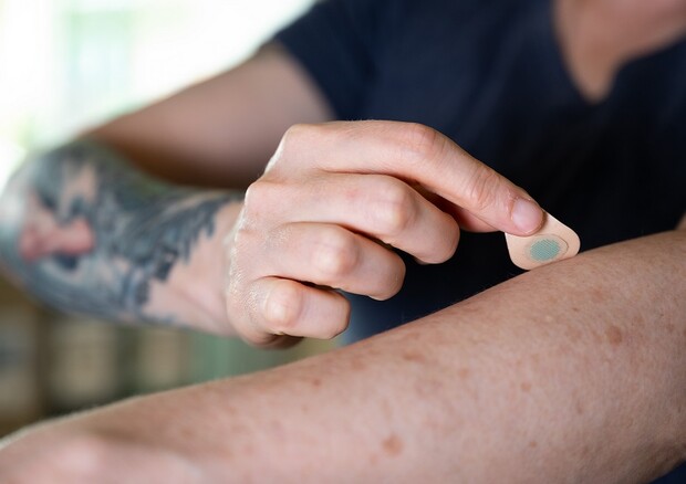 L’applicazione di un cerotto a microaghi per un tatuaggio fai-da-te (fonte: Georgia Tech) © Ansa