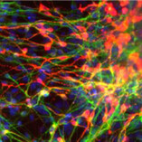 Cellule staminali adulte del cervello (fonte: UC San Diego School of Medicine)