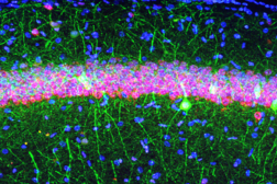 Microfotografia al microscopio a fluorescenza di neuroni dell’ippocampo. Fonte: Istituto Italiano di Tecnologia - © IIT, all rights reserved