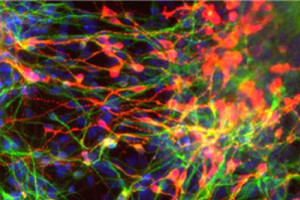 Cellule staminali adulte del cervello (fonte: UC San Diego School of Medicine) (ANSA)