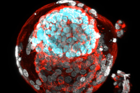 Il sosia dell’embrione umano ottenuto a partire da cellule staminali (fonte: Oldak et al, Nature)