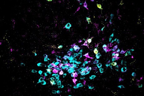 I colori rappresentano l'attività dei neuroni che si attivano quando scatta la sensazione di paura (fonte: Spitzer Lab, UC San Diego)