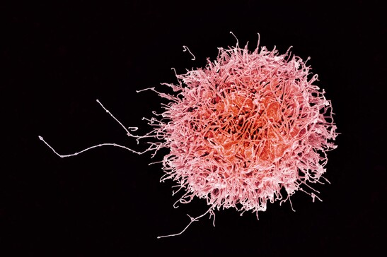 Una cellula del sistema immunitario umano (fonte: National Institutes of Allergy and Infectious Diseases, National Institutes of Health, da Flickr)