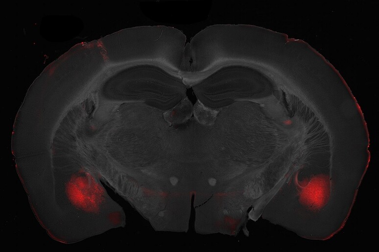 In rosso la regione basolaterale dell’amigdala al microscopio confocale (fonte: IIT) - RIPRODUZIONE RISERVATA