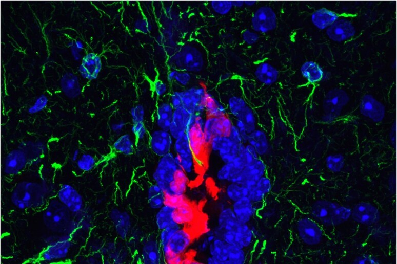 In rosso le cellule ependimali con proprietà di staminali nel sistema nervoso centrale (fonte: B. Frederico) - RIPRODUZIONE RISERVATA