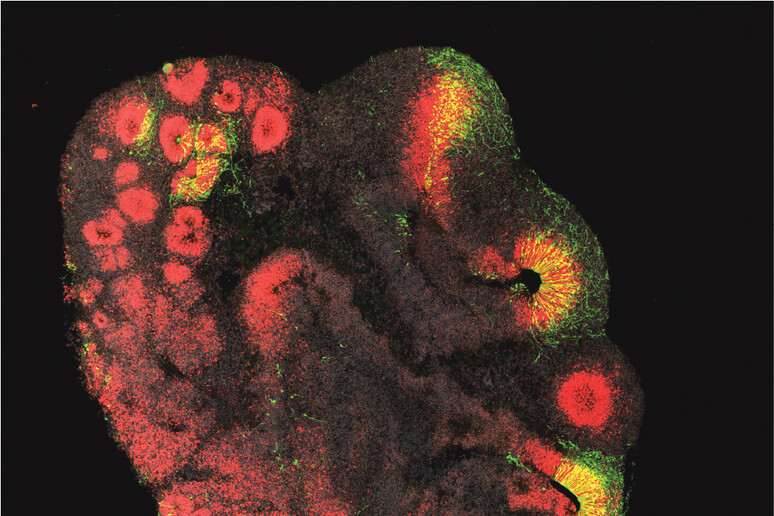 Organoide cerebrale di 3 millimetri ottenuto a partire da cellule staminali di scimpanzé: in rosso le normali cellule staminali, in verde quelle che hanno ricevuto il gene ARHGAP11B responsabile del maggiore sviluppo (Fonte: Jan Fischer) - RIPRODUZIONE RISERVATA
