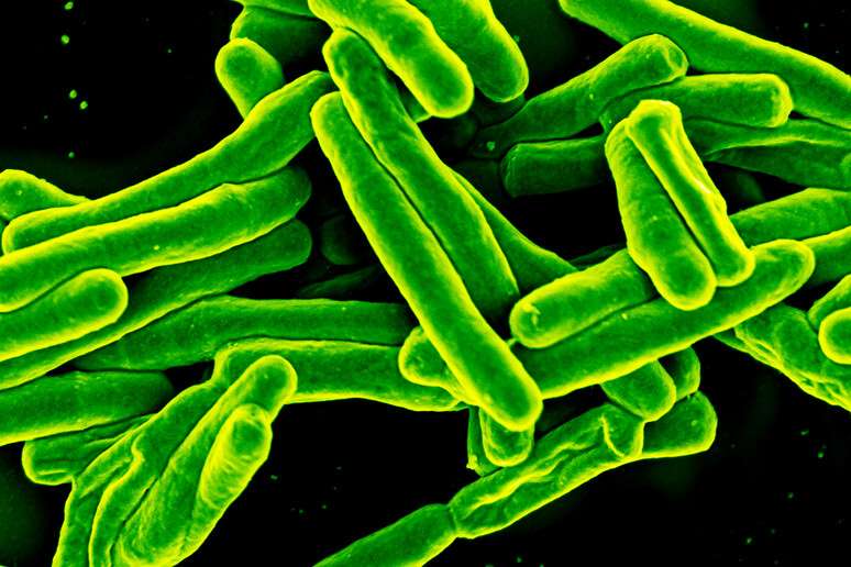 Il Mycobacterium tuberculosis visto al microscopio elettronico (fonte: NIAID) - RIPRODUZIONE RISERVATA
