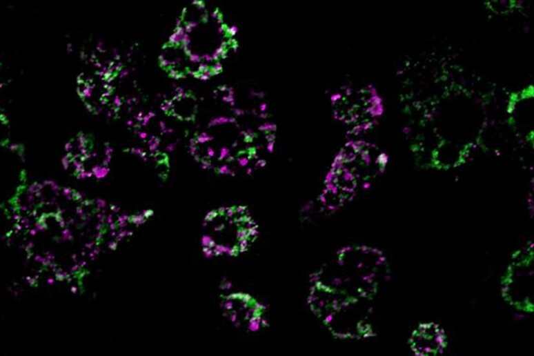 Mitocondri delle cellule adipose (fonte: UC San Diego Health Sciences) -     RIPRODUZIONE RISERVATA